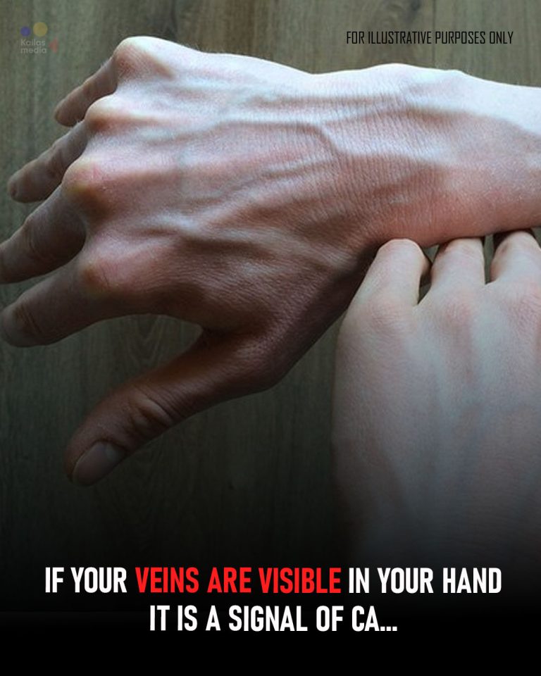 Visible Veins Explained: Normal Causes, Health Risks, and When to Worry